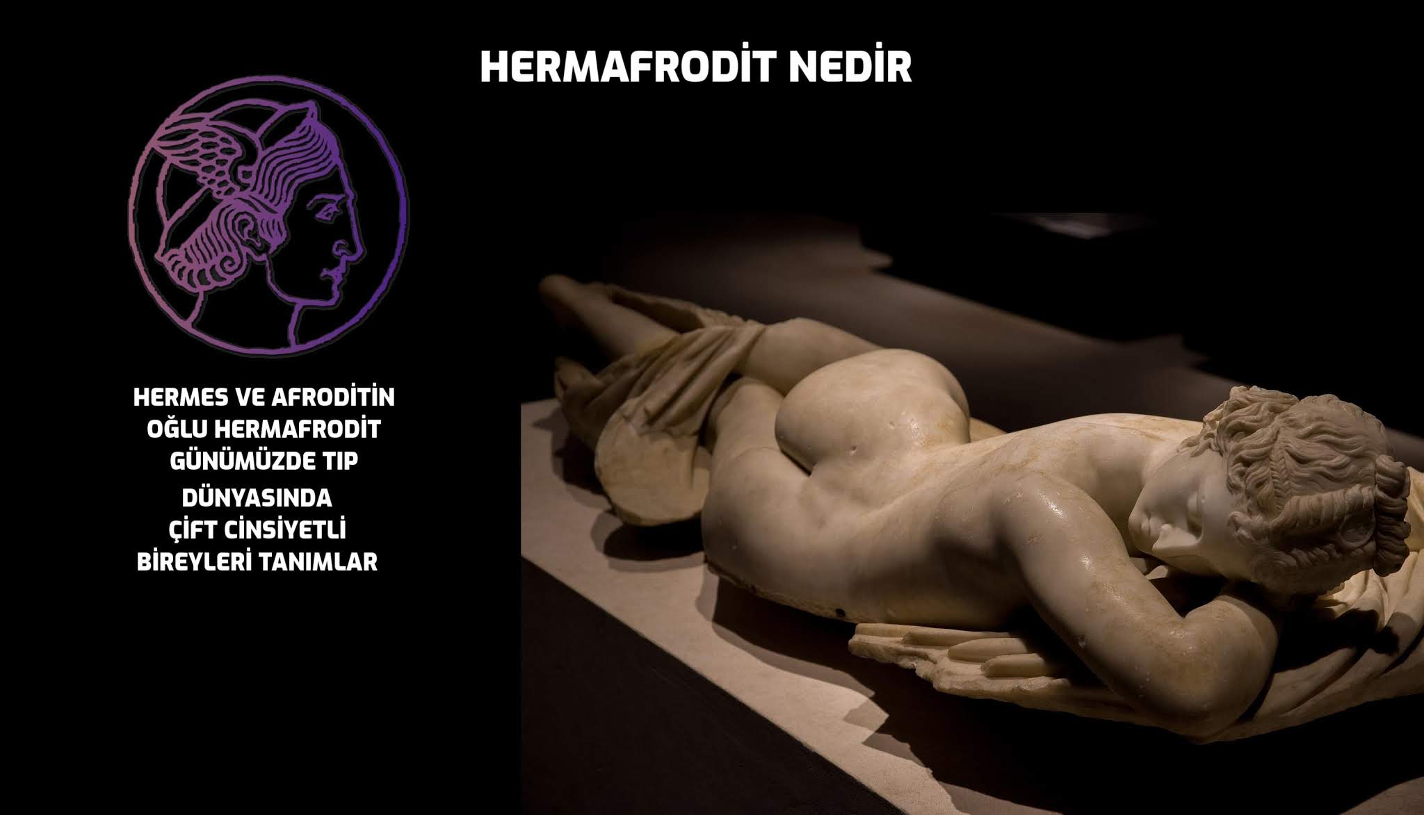 Hermafrodit nedir – Eşcinsel de olabilirler mi ?